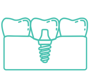 image of dental implant