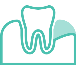 Periodontal Pocket Reduction