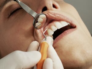 dentist looking at gums and teeth